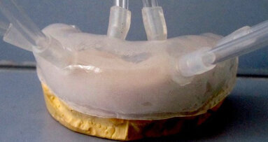 El aclaramiento dental biológico