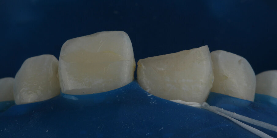 Case 1: Before cleaning