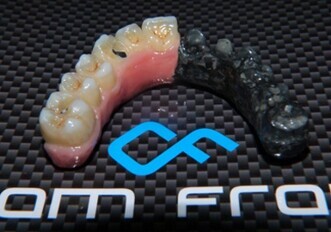 Dream Frame + M.C.M. (monolithic composite method)