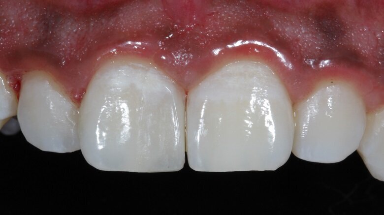 Fig 18: Initial form