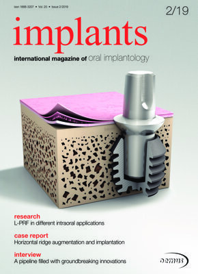 implants international No. 2, 2019 implants international No. 2, 2019