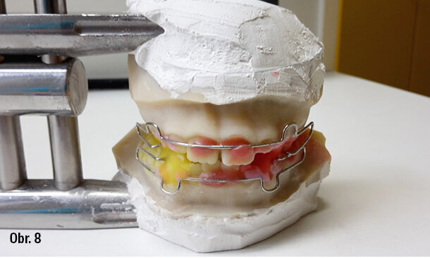 Sypání pryskyřice