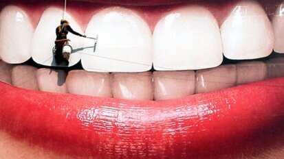 Zubna caklina oslabljena izbeljivanjem