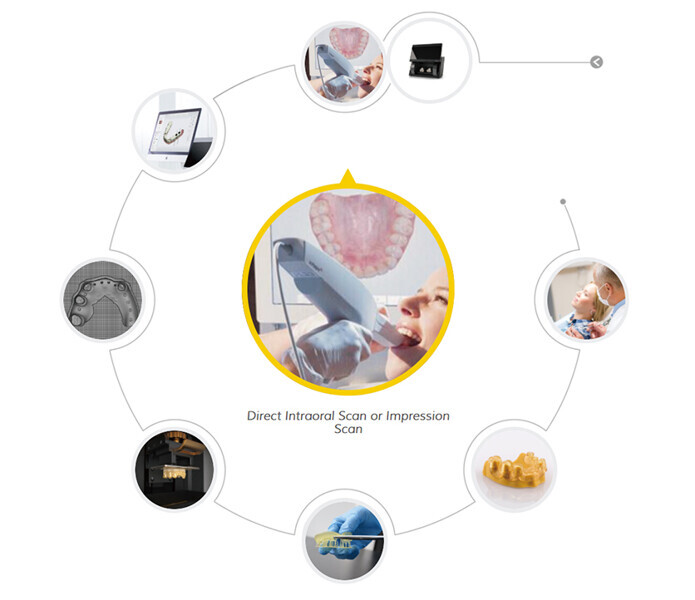 002-direct-intraoral-scan-or-impression-scan