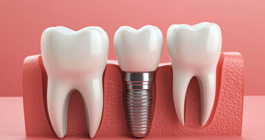 Titan im Fokus: Schweizer Forscherin untersucht Implantat-Grenzflächen