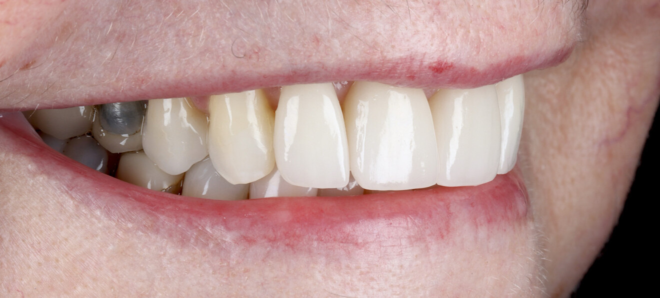 Fig. 24c: Lateral view from the right side. 