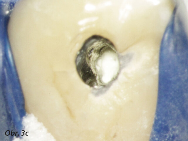 Aplikace PD MAP White pomocí MAP systému