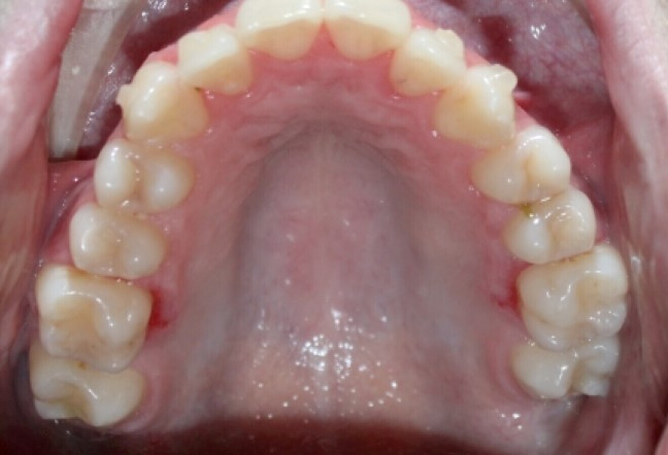 Fig. 15: After six months of expansion.