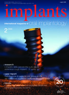 implants Italy No. 2, 2025 implants Italy No. 2, 2025