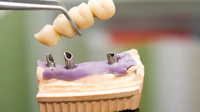 Neue Gütesiegel für zahntechnische Erzeugnisse Neue Gütesiegel für zahntechnische Erzeugnisse