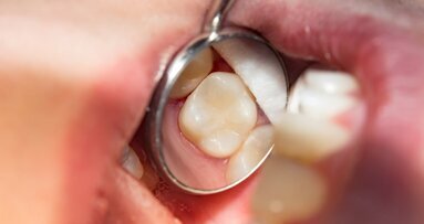 Glass hybrids versus composite: Efficacy and cost-effectiveness in a multicentre clinical study