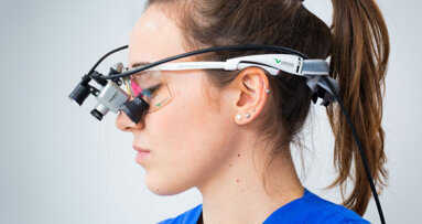 Catturare l’esatta visuale dell’operatore