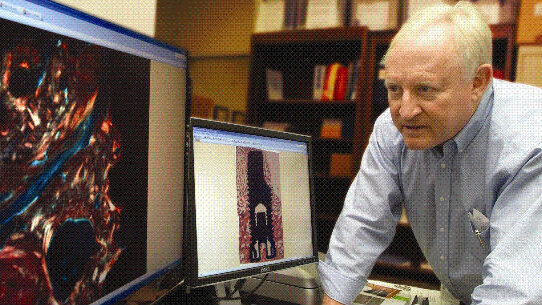 Le proteine ossee morfogenetiche potrebbero migliorare il successo del trattamento implantare