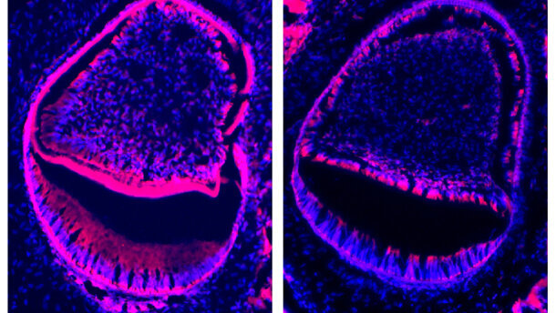 Genetic discovery could lead to advances in dental treatment