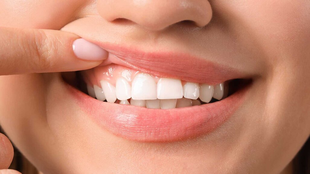 Dentale Kampagne für präventions­orientierte Patientenversorgung