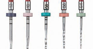 Odgovori na dva najčešće postavljana pitanja u kliničkoj endodonciji