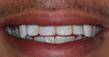 ¡Estética no se escribe con $!