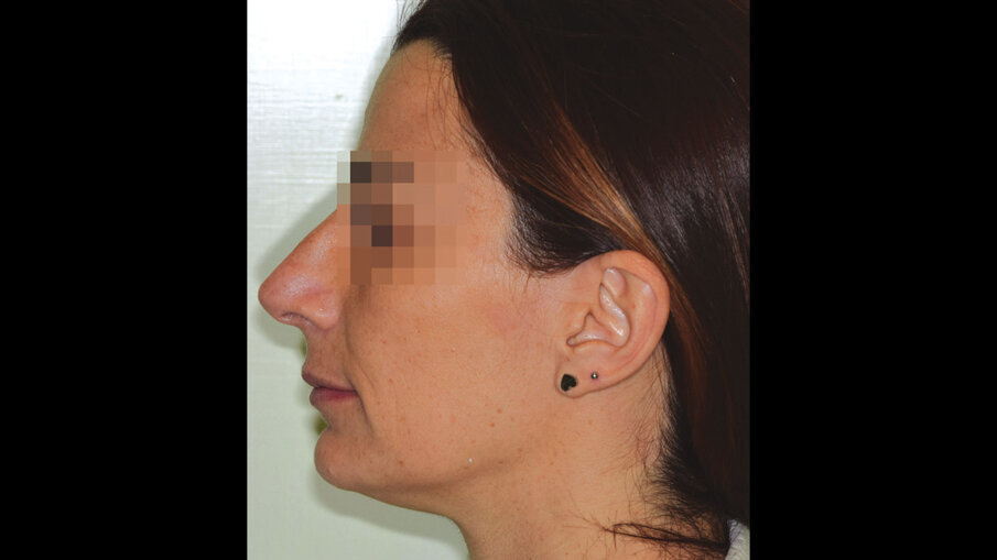 Figg. 8a-8c_Foto extraorali di fine trattamento.