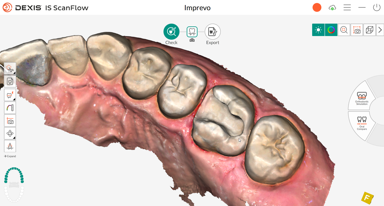 Λογισμικό IS ScanFlow 2.0.