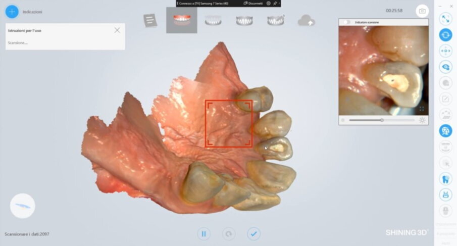 Figg. 5, 6_Arco superiore.