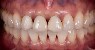 Meeting high functional and aesthetic demands with ceramic solutions