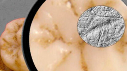 L’analisi dei denti mostra i vantaggi dell’uomo moderno su quello di Neanderthal