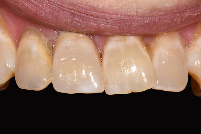 Fig. 8: Resultado. Vista detallada que no deja lugar a dudas: se imitó a la naturaleza en todas sus facetas.