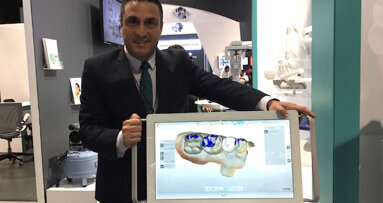 MyCrown, restauraciones en dos horas desde el sillón