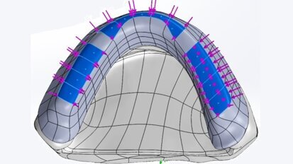 Numeryczna weryfikacja problematyki mocowania protezy całkowitej wspartej o implant