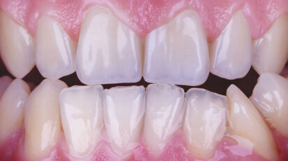 Hay que elegir siempre el camino más difícil