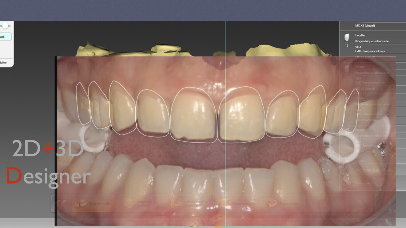 Fig. 8: Synchronisation of 2D and 3D images.
