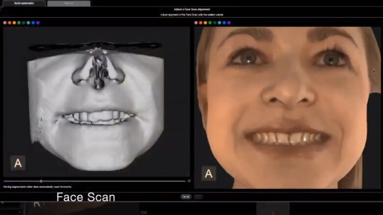 CBCT, Vaše cesta k úspěchu – pokročilý extraorální zobrazovací systém