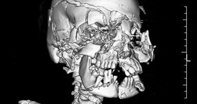 Forensic odontology—Broader than just identification