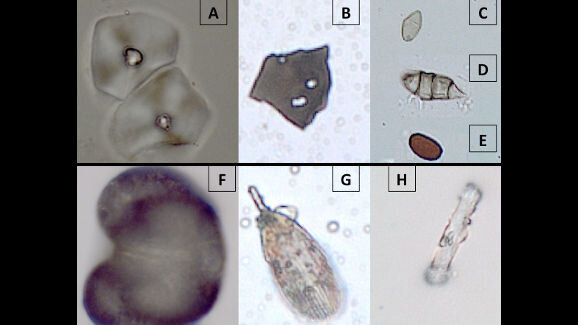 Ancient dental plaque reveals living conditions and diet of early hominins