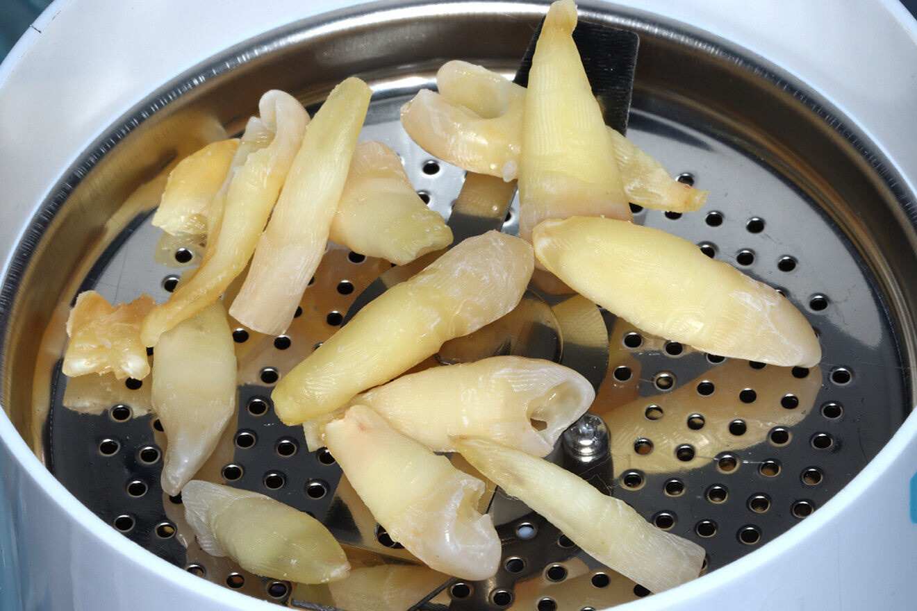 Fig. 12a: Using extracted teeth to achieve autologous bone substitute using the Smart Dentin Grinder.