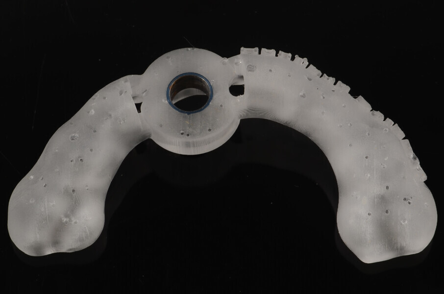 Fig. 10: 3D-printed surgical guide, occlusal view.