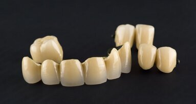 Metal ceramics remain gold standard, review study suggests