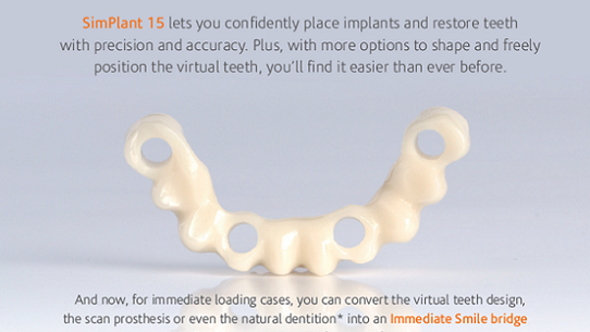 SimPlant® 15 – Maggiore predicibilità della procedura chirurgica e della ricostruzione protesica