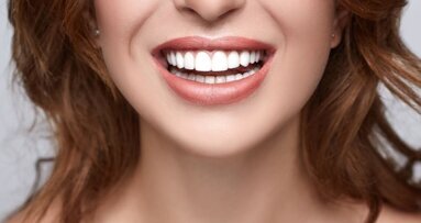 Tanden bijwerken met een nagelvijl?