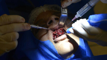 Dentistas brasileños atienden gratis a víctimas de abuso Dentistas brasileños atienden gratis a víctimas de abuso