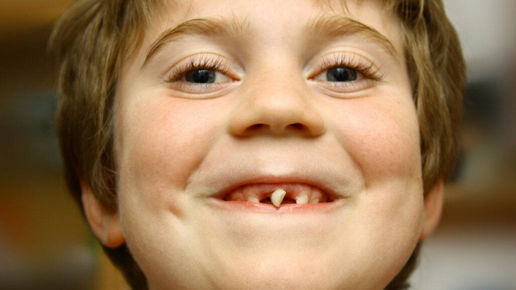 Bijna één op de vijf kinderen niet naar tandarts