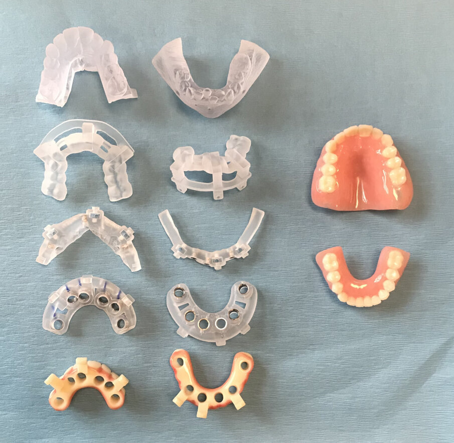 Fig. 5: Surgical guides and provisional restorations.