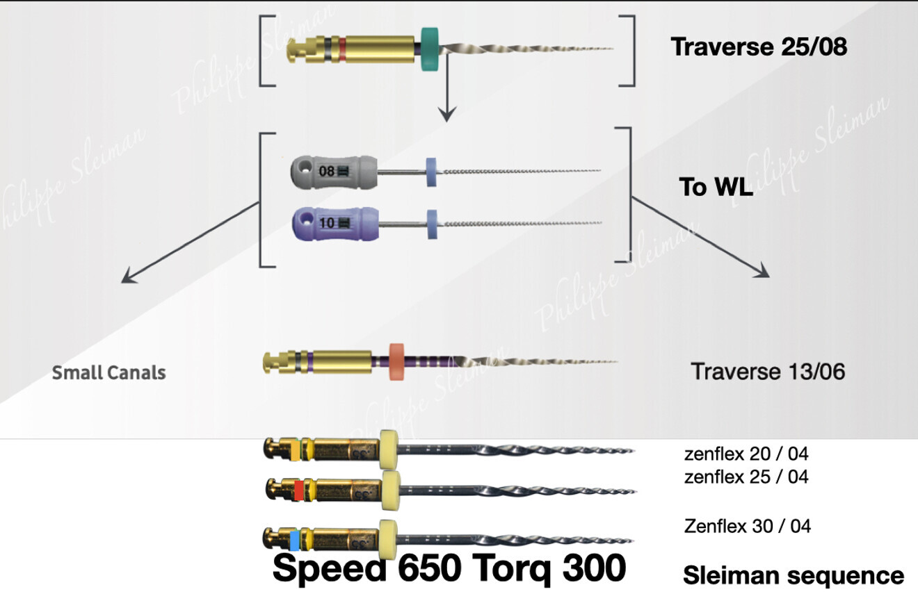 Fig. 7: Technical card for narrow canals.
