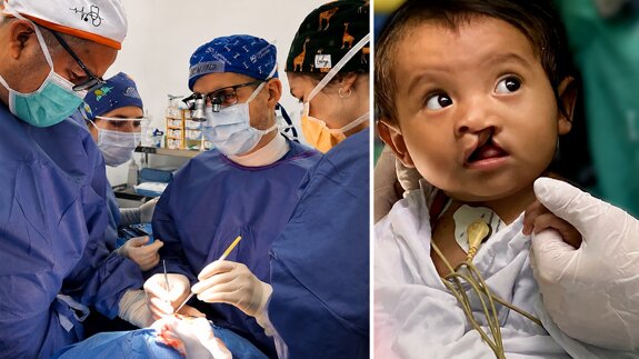 Donación de motor de implantología para cirugía de labio leporino