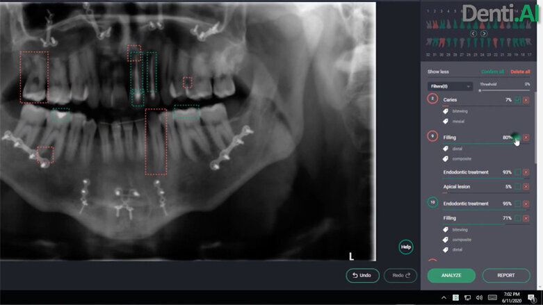 La inteligencia artificial en la investigación clínica
