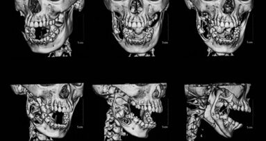 Orthodontic treatment planning possible without radiation exposure