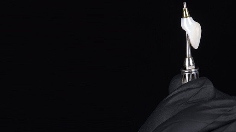 Minimally invasive implant therapy in the anterior zone