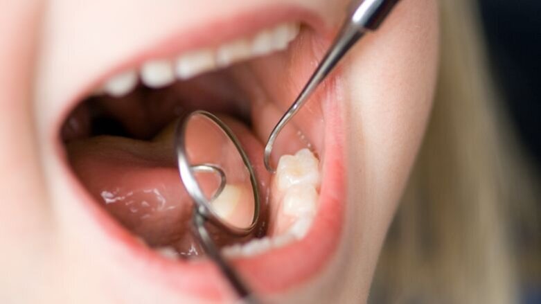 Mondgezondheid tieners verslechterd