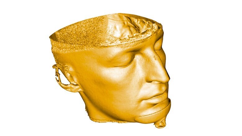 Fig. 3. Cráneo virtual en archivo DICOM que contiene información sobre la densidad del tejido.