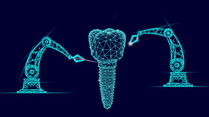 Allisone Technologies now offers dental implant recognition with acquisition of Spotimplant